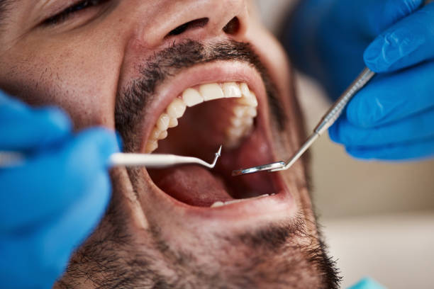 Best Walk-In Emergency Dentist in Wilson, WY