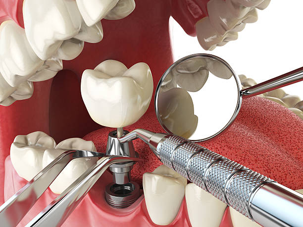 Fast & Reliable Emergency Dental Services in WY